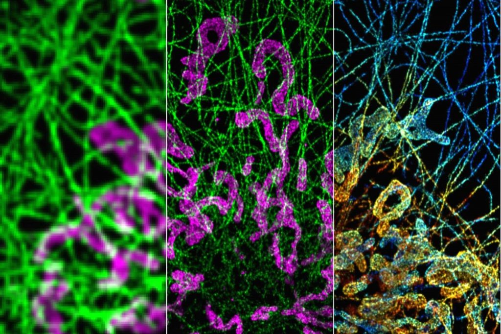 Superresolution image of microtubules and mitochondria